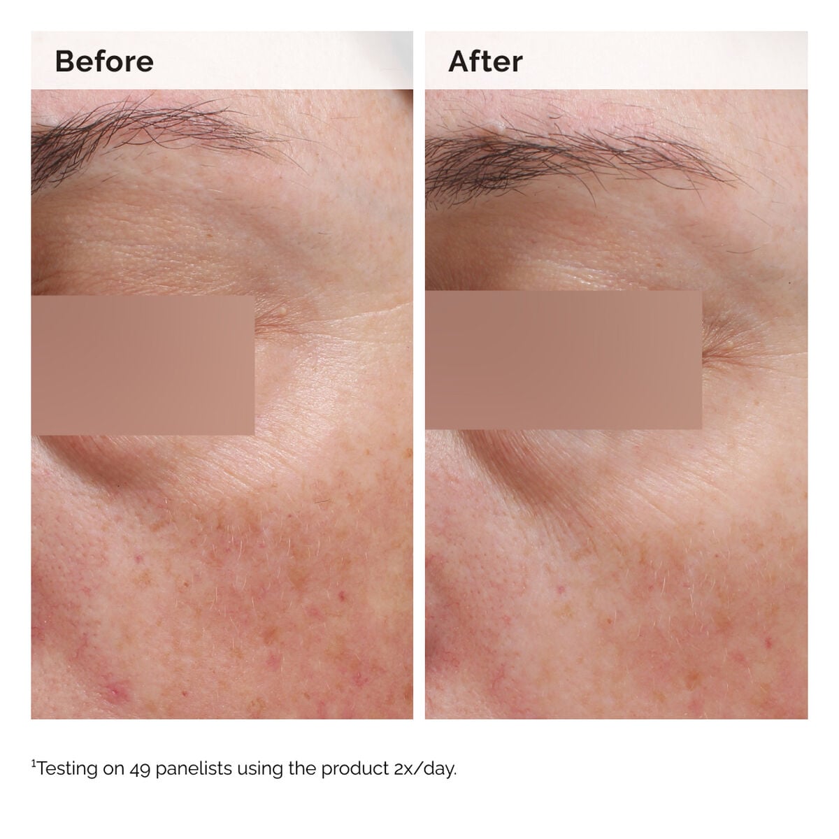niacinamide-5-face-and-body-emulsion-a1 2024-08-23-ORD-Nia-5pct-Face-Body-B-A-Elasticity-Global-02-1x1.jpg