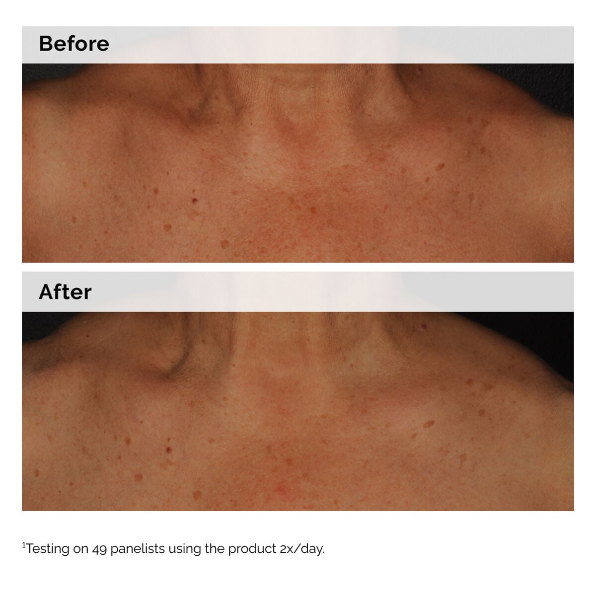 niacinamide-5-face-and-body-emulsion-a1 2024-08-23-ORD-Nia-5pct-Face-Body-B-A-Global-02-1x1.jpg
