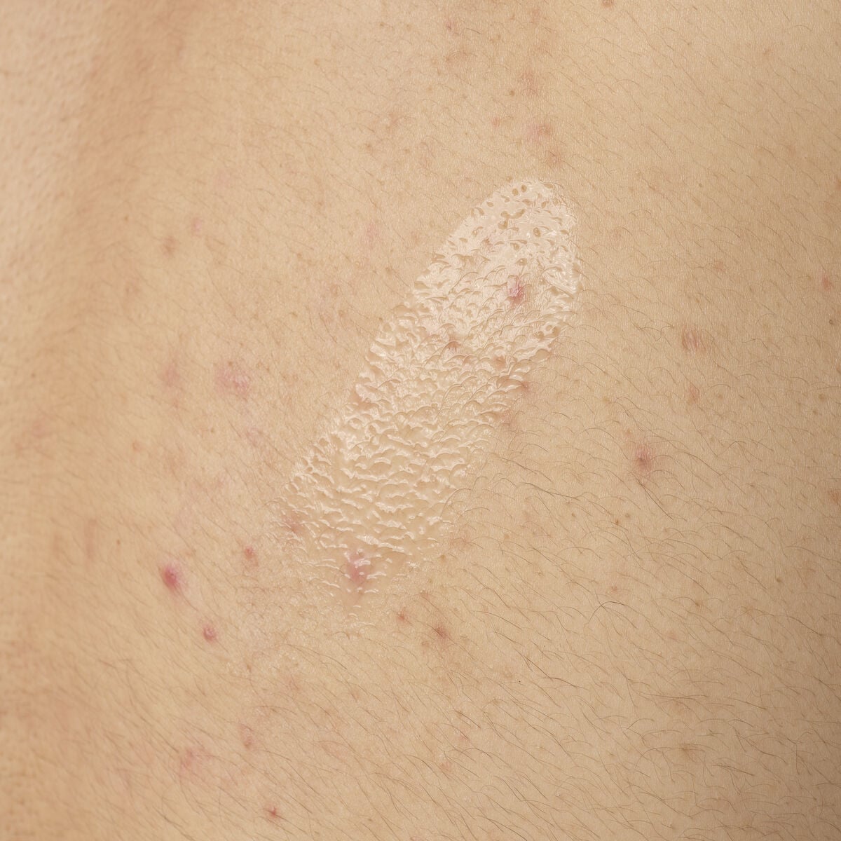 salicylic-acid-0-5-body-serum-g6 ORD-salicylic-acid-05-body-240ml-application.jpg