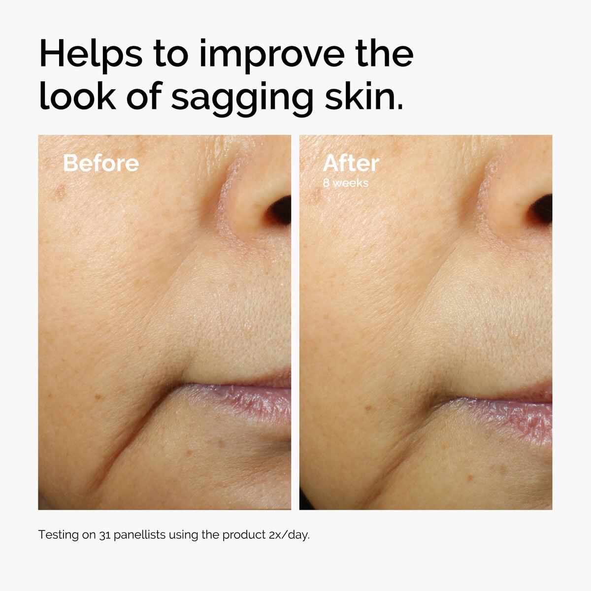 caffeine-3-escin-1-face-serum-t1 ord-caffeine-3pct-escin-1pct-face-serum-before-after-sagging.jpg