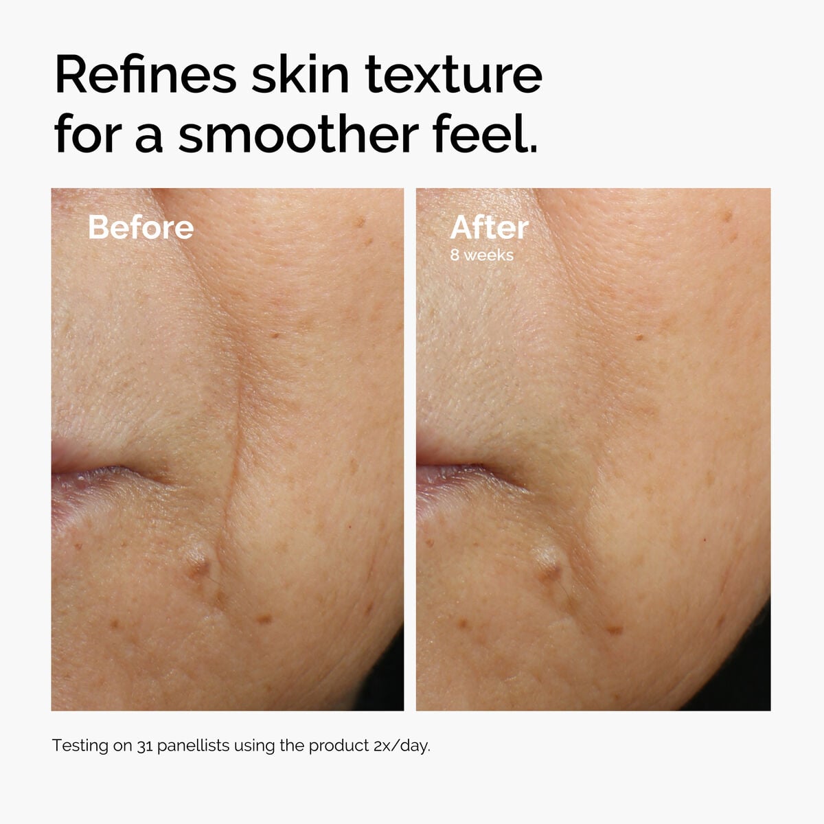 caffeine-3-escin-1-face-serum-t1 ord-caffeine-3pct-escin-1pct-face-serum-before-after-texture.jpg