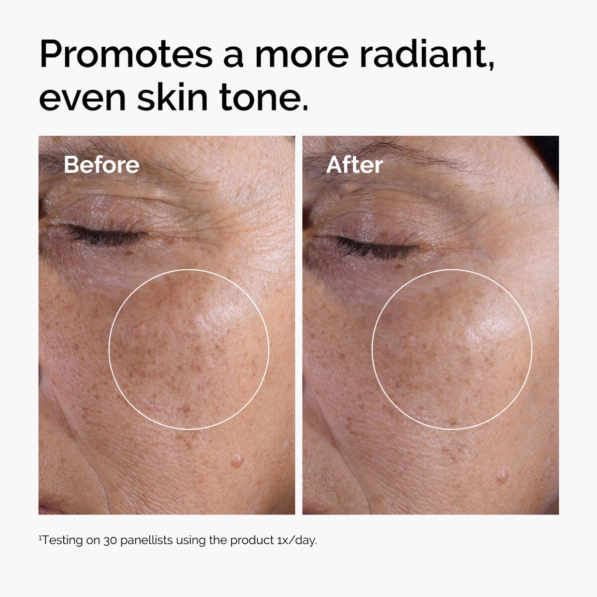 glycolic-acid-7-exfoliating-toner-y6 ord-glycolic-before-after-radiance.jpg