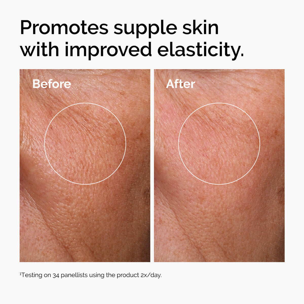 hyaluronic-acid-2-b5-with-ceramides-k0 ord-hyaluronic-acid-2pct-b5-hydrating-serum-before-after-elasticity.jpg