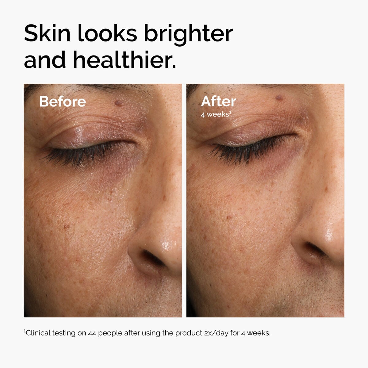multi-antioxidant-radiance-serum-q6 ord-mars-before-after-healthy.jpg