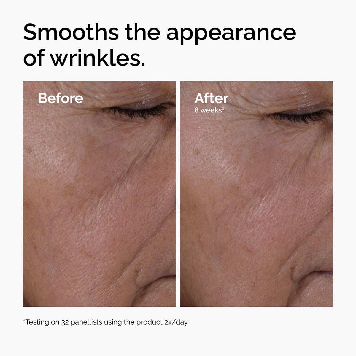 multi-peptide-ha-serum-z3 ord-multi-peptide-ha-serum-wrinkles-before-after.jpg