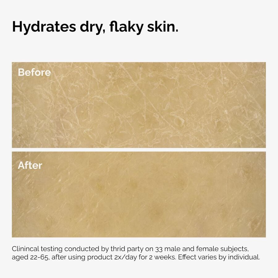 the-body-care-collection-w2 ord-natural-moisturizing-factors-inulin-body-before-after-graphic-02.jpg