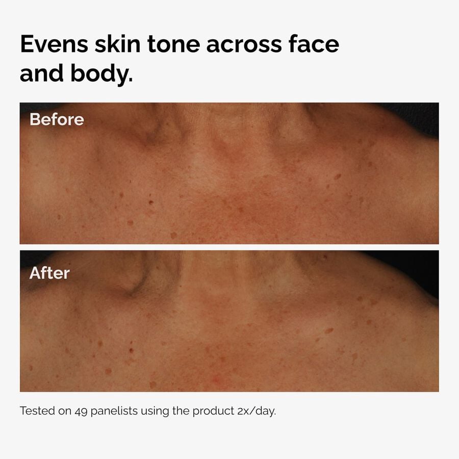the-body-care-collection-w2 ord-niacinamide-face-body-serum-before-after-even-tone-graphic.jpg