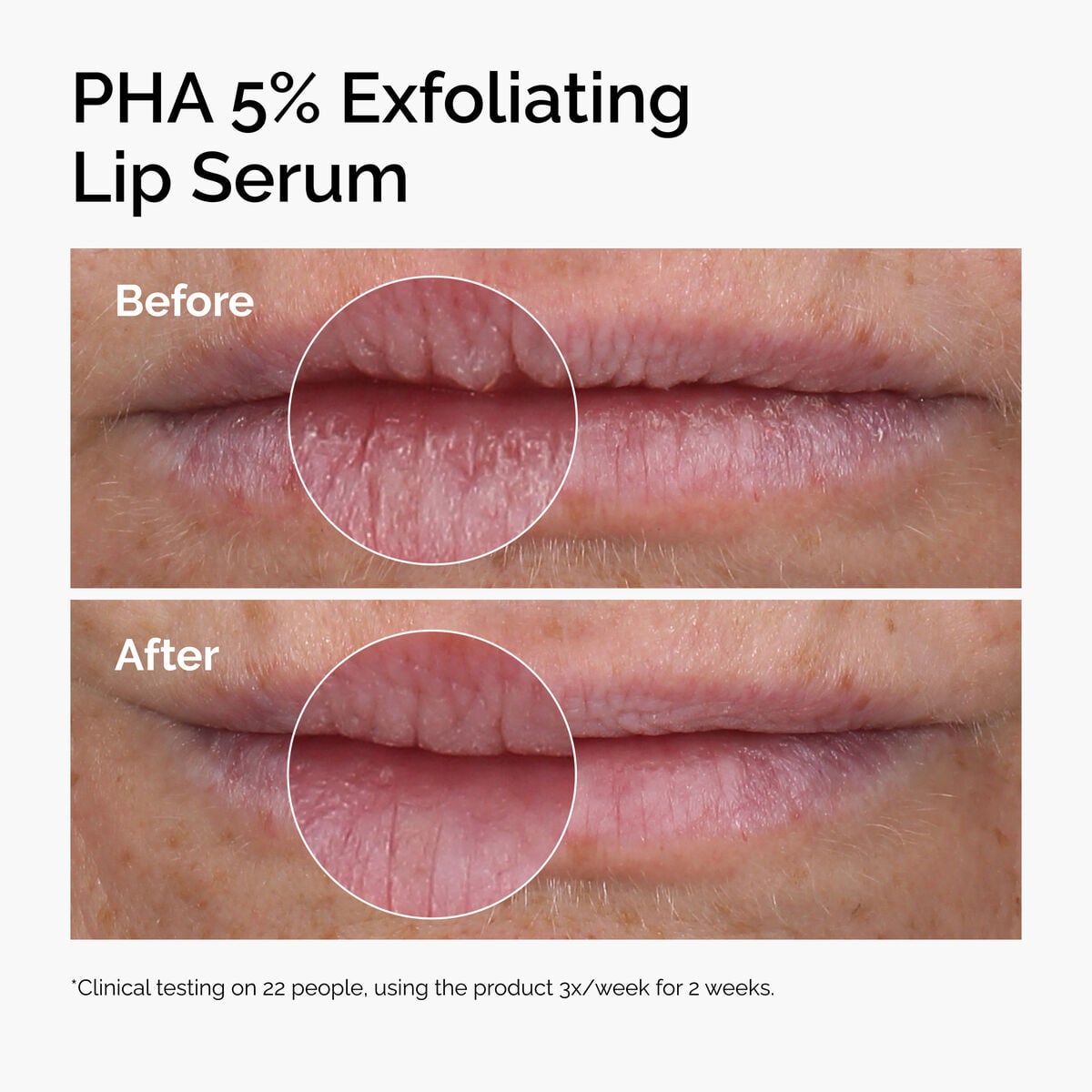 pha-5-exfoliating-lip-serum-r8 ord-pha-5pct-lip-exfoliating-serum-before-after.jpg